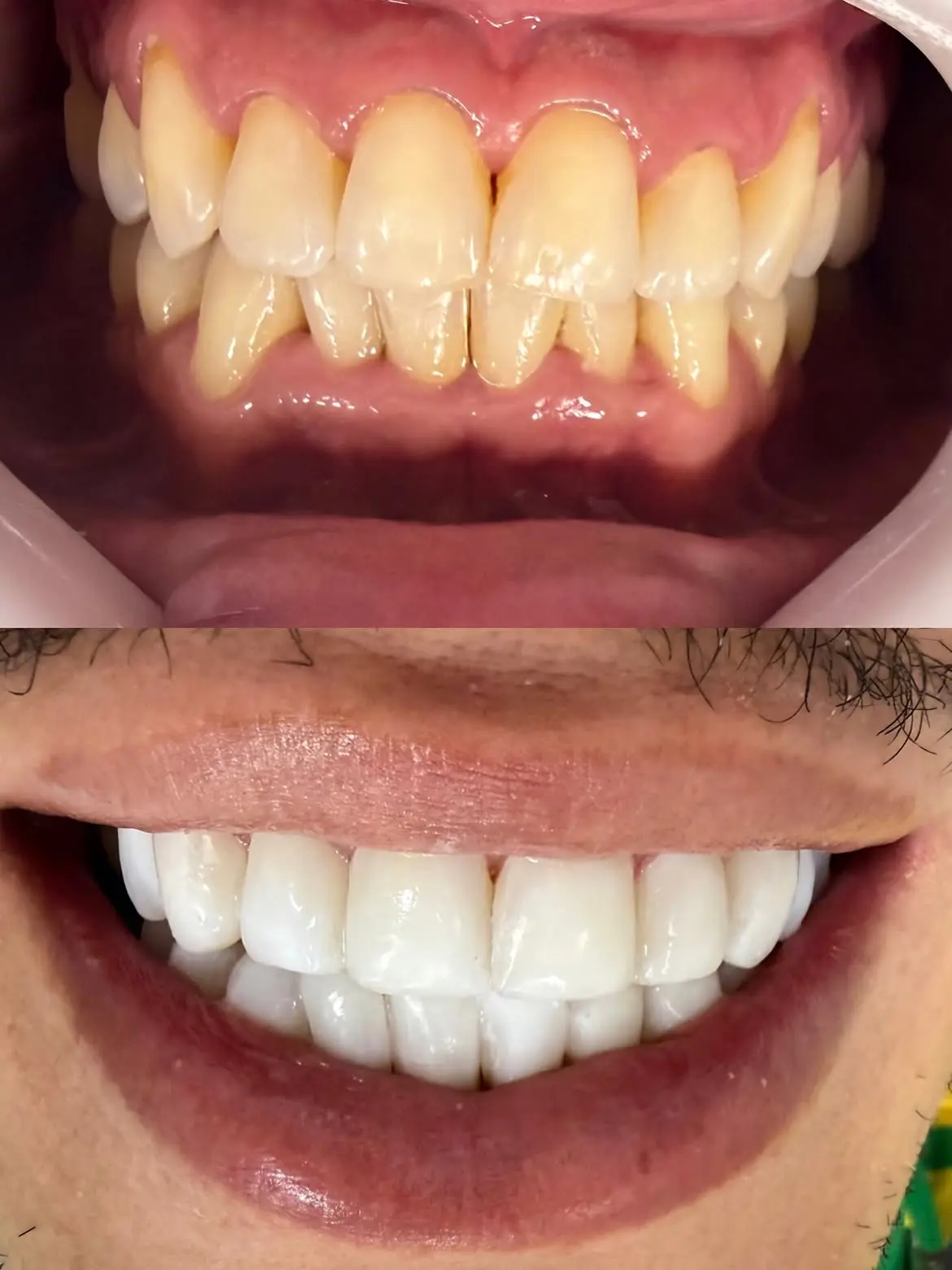 Resultado de tratamento odontológico 06