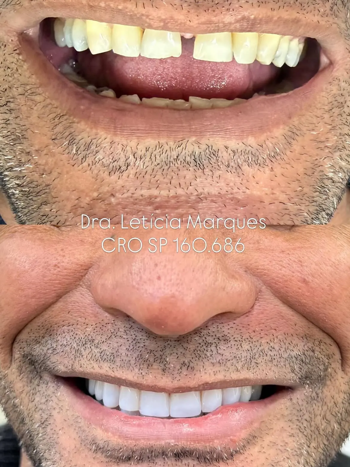 Resultado de tratamento odontológico 05