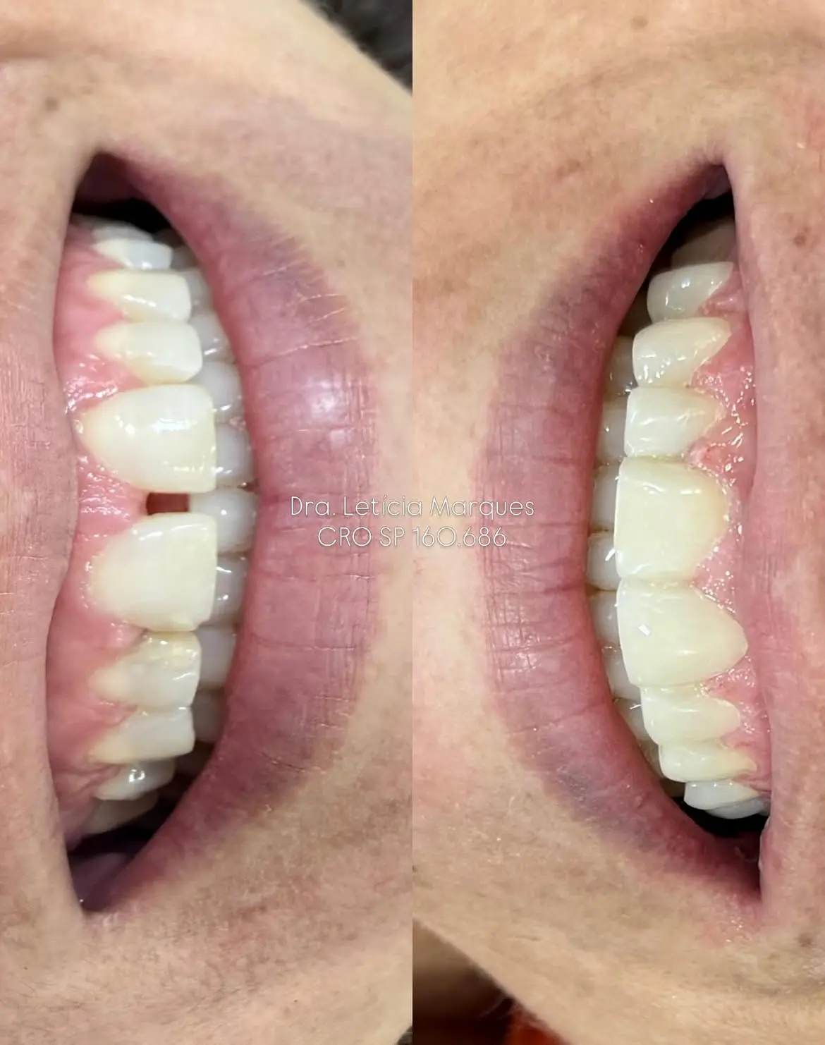 Resultado de tratamento odontológico 04