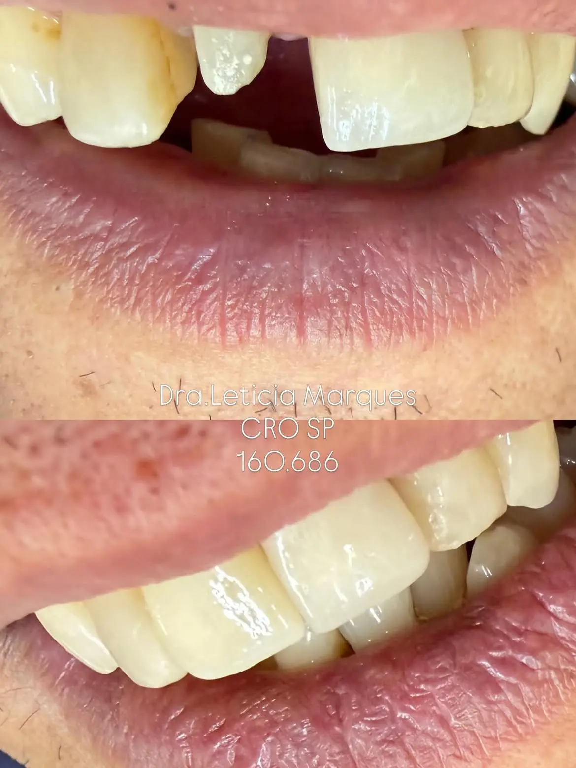 Resultado de tratamento odontológico 03