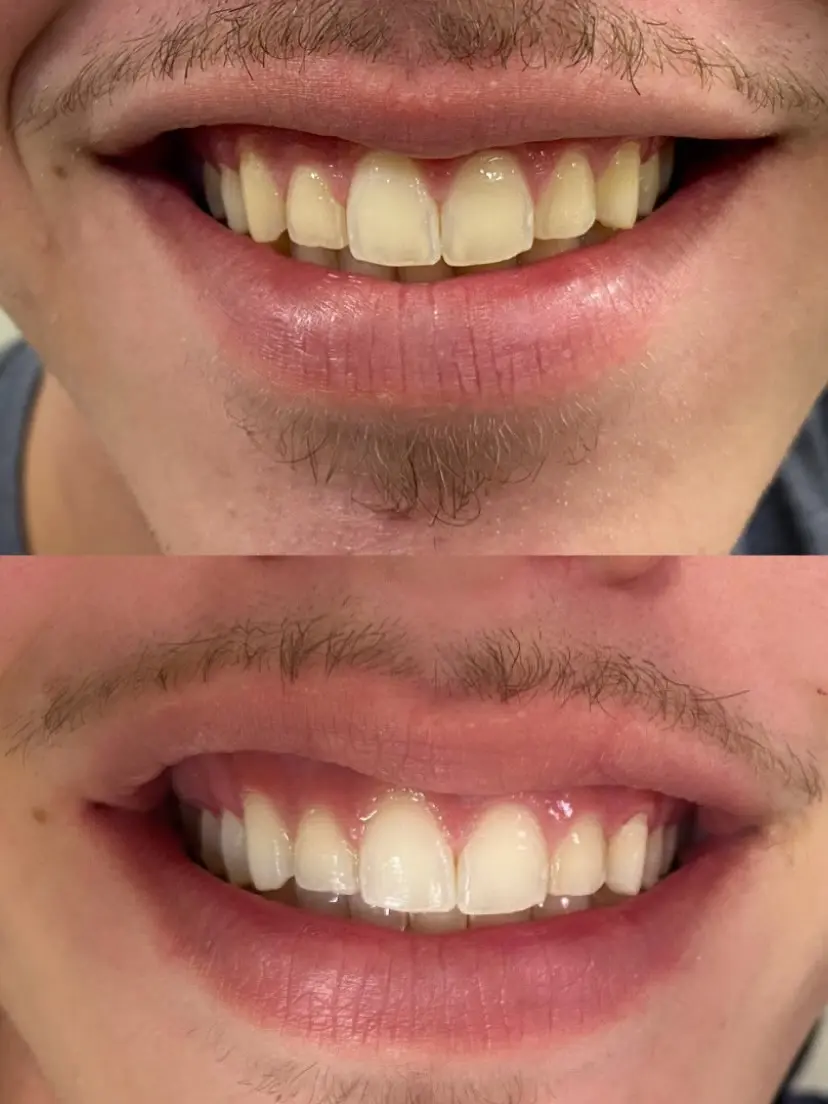 Resultado de tratamento odontológico 02