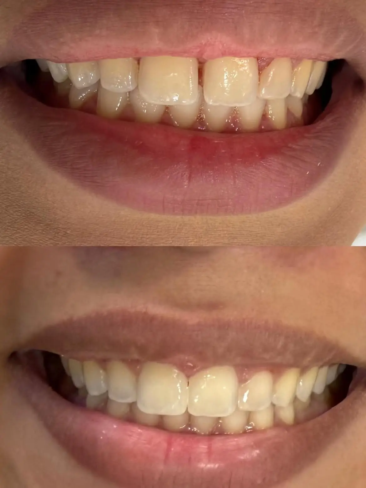 Resultado de tratamento odontológico 01