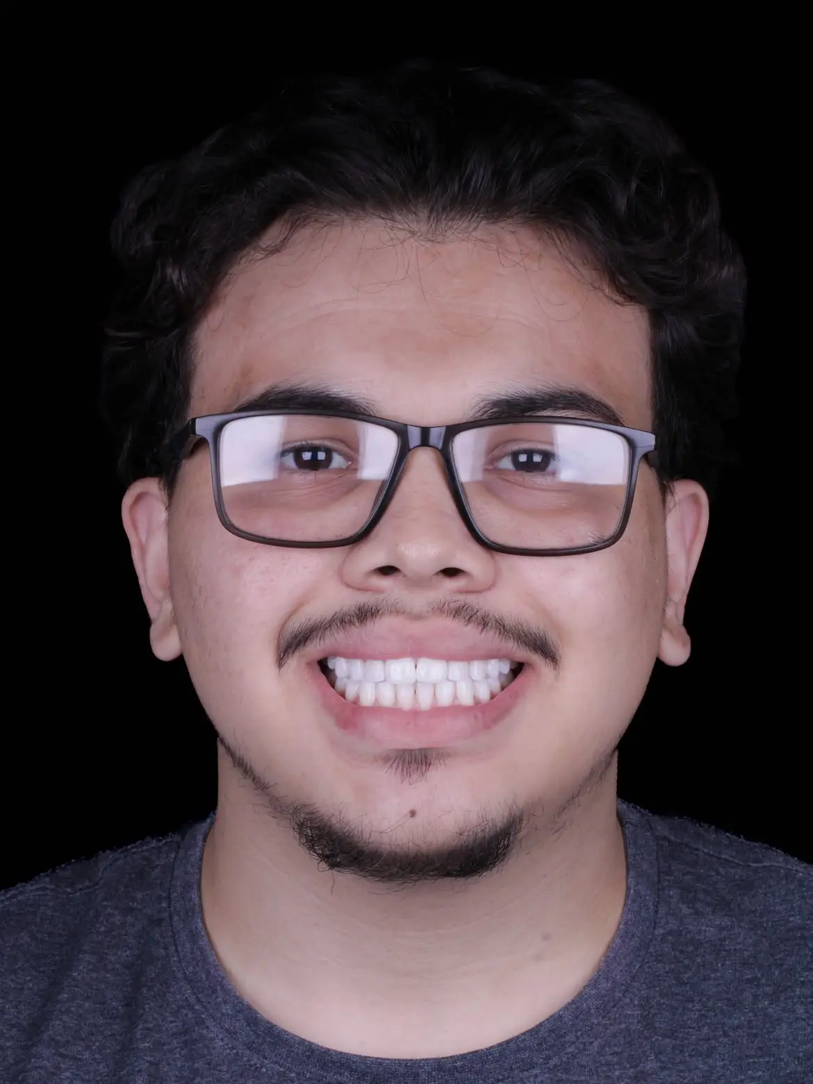 Resultado de tratamento odontológico 2