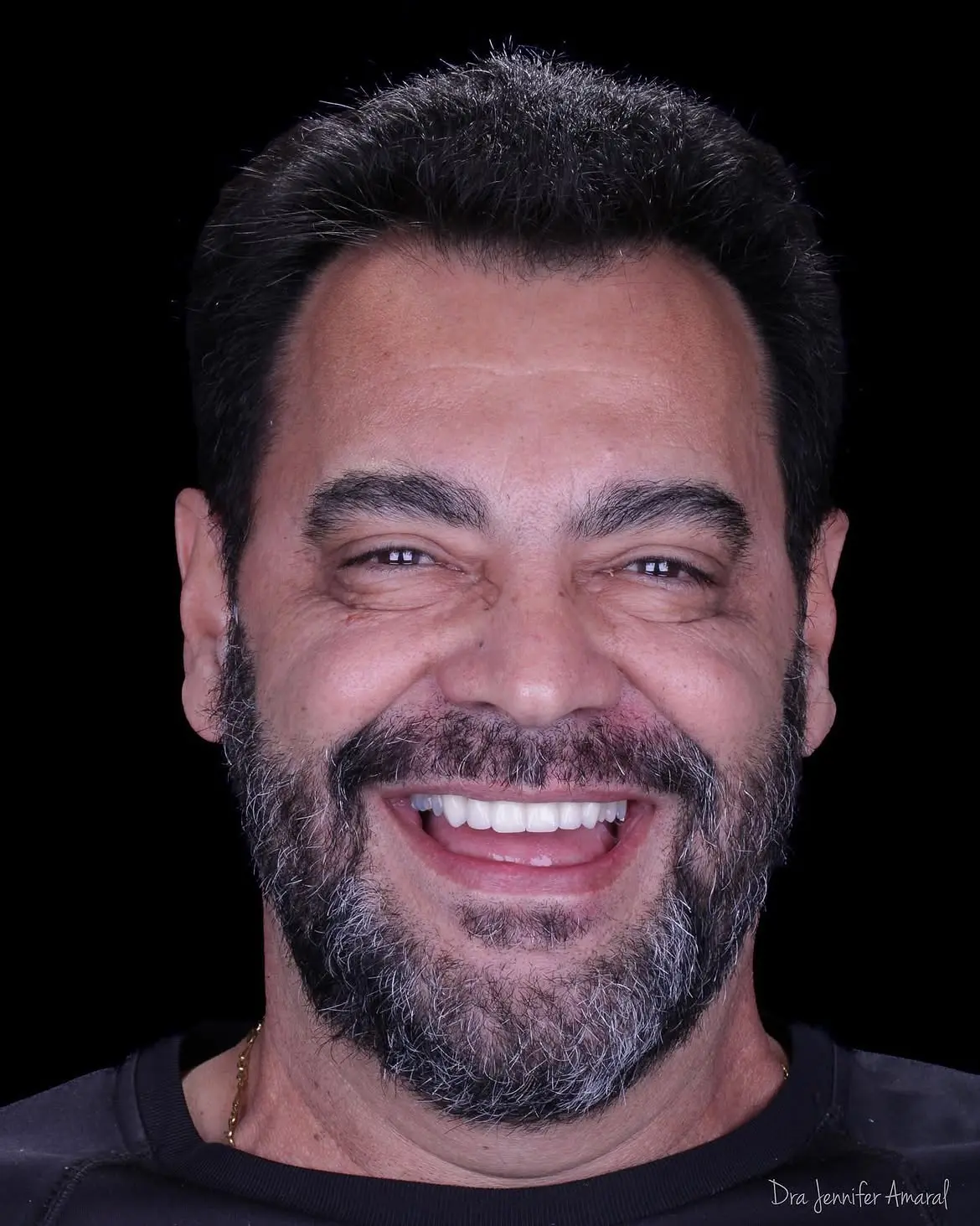 Resultado de tratamento odontológico 4